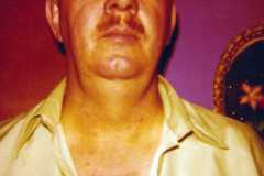 1976-08-01-ArnoldLD1929-02